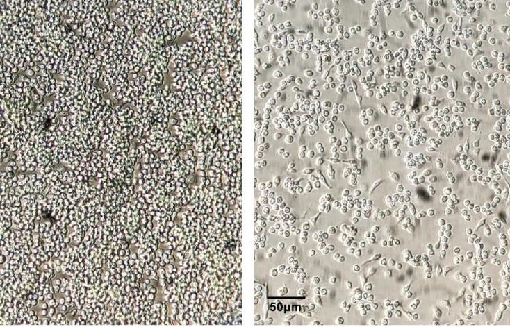 Key Factors Affecting Cell Culture: Cell Density