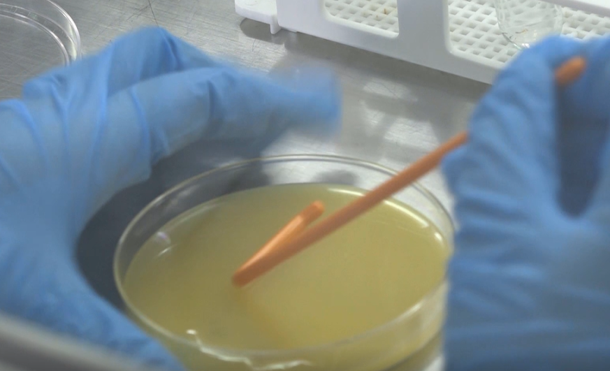 A Detailed Introduction to the Spread Plate Method for Dilution (Principle and Steps)